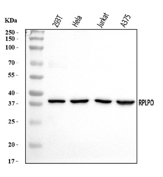 RPLP0 Antibody