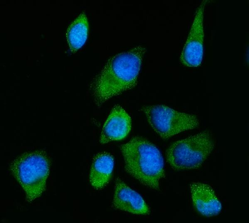 RPS2 Rabbit Polyclonal Antibody