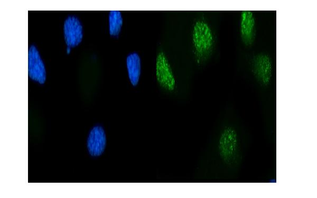 MSK2/RSK-B/RPS6KA4 Antibody