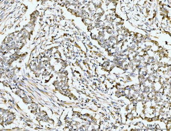 MSK2/RSK-B/RPS6KA4 Antibody