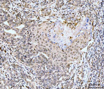 MSK2/RSK-B/RPS6KA4 Antibody