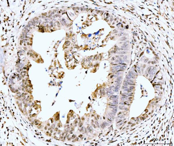 MSK2/RSK-B/RPS6KA4 Antibody