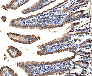 MSK2/RSK-B/RPS6KA4 Antibody