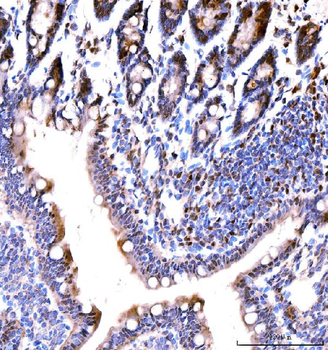 MSK2/RSK-B/RPS6KA4 Antibody