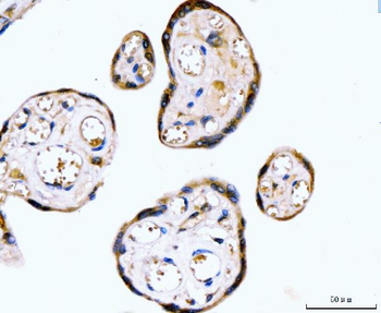 RYR2 Rabbit Polyclonal Antibody