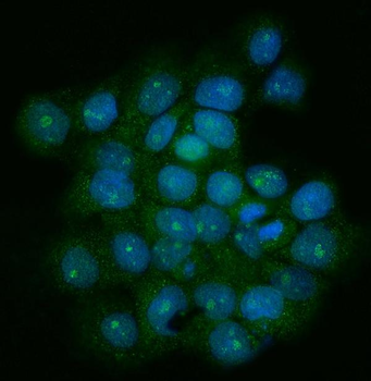 TRF1/TERF1 Rabbit Polyclonal Antibody