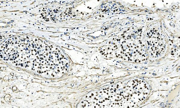 AP2 gamma/TFAP2C Rabbit Polyclonal Antibody