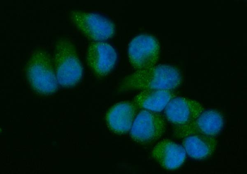 VAV3 Rabbit Polyclonal Antibody
