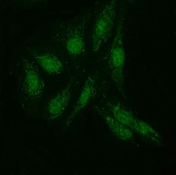 KIAA1429/VIRMA Rabbit Polyclonal Antibody