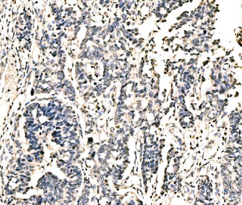 KIAA1429/VIRMA Rabbit Polyclonal Antibody