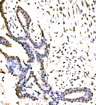 KIAA1429/VIRMA Rabbit Polyclonal Antibody