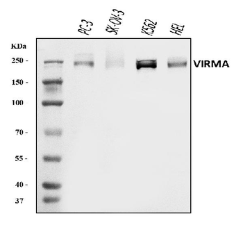 KIAA1429/VIRMA Rabbit Polyclonal Antibody