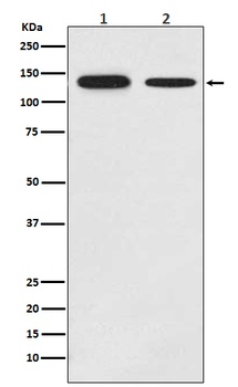 Growth hormone receptor Rabbit Monoclonal Antibody