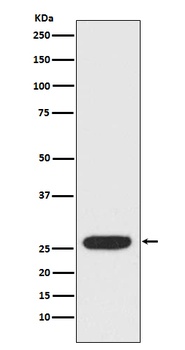 StAR Rabbit Monoclonal Antibody