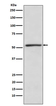 TBLR1 Rabbit Monoclonal Antibody