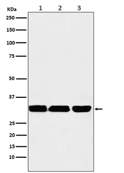 p53 DINP1 Rabbit Monoclonal Antibody