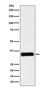 IGFBP2 Rabbit Monoclonal Antibody