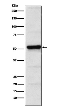 PICK1 Rabbit Monoclonal Antibody