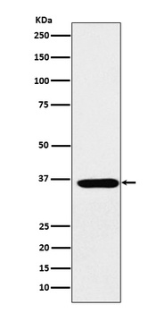 SMN1 Rabbit Monoclonal Antibody