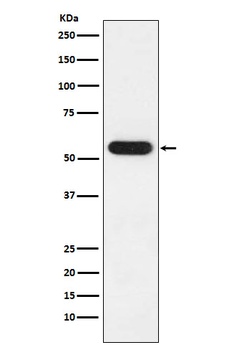 FKBP52 Rabbit Monoclonal Antibody