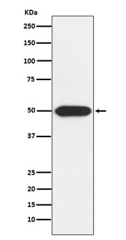 PRKAR1A Rabbit Monoclonal Antibody