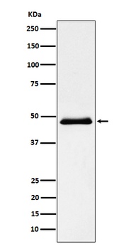 Pancreatic Lipase （PNLIP） Rabbit Monoclonal Antibody
