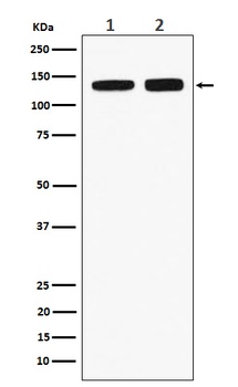 RNF40 Rabbit Monoclonal Antibody