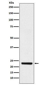 HB/EGF Rabbit Monoclonal Antibody