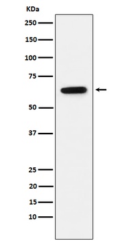 Estrogen Receptor alpha Rabbit Monoclonal Antibody