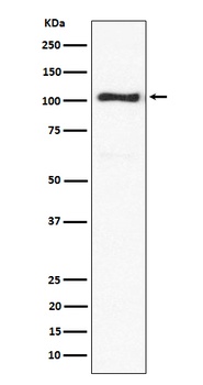ACTN3 Rabbit Monoclonal Antibody