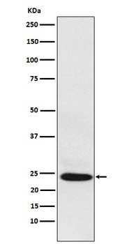 BAG2 Rabbit Monoclonal Antibody