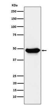 ENTPD5 Rabbit Monoclonal Antibody