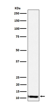SPINK1 Rabbit Monoclonal Antibody