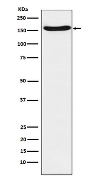 FANCA Rabbit Monoclonal Antibody