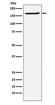 SMC4 Rabbit Monoclonal Antibody