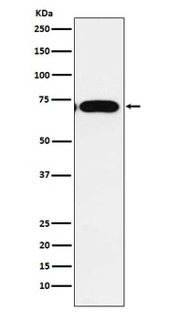 CPEB1 Rabbit Monoclonal Antibody