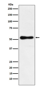 ROR beta Rabbit Monoclonal Antibody