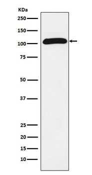 ROR2 Rabbit Monoclonal Antibody