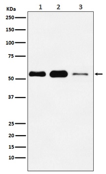 ATGL/PNPLA2 Rabbit Monoclonal Antibody