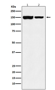 KDM4B / JMJD2B Rabbit Monoclonal Antibody