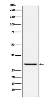 TIRAP Rabbit Monoclonal Antibody