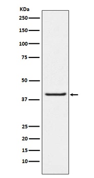 PAR4 Rabbit Monoclonal Antibody