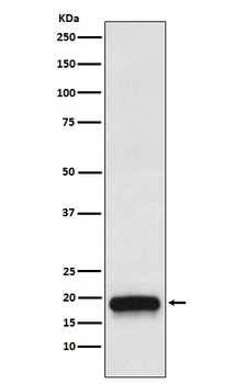 VEGFB Rabbit Monoclonal Antibody