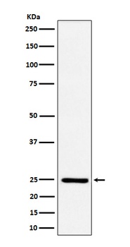 Ephrin A1 Rabbit Monoclonal Antibody