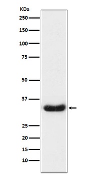 LEFTY1 + LEFTY2 Rabbit Monoclonal Antibody