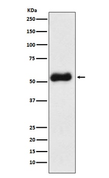 Thromboxane synthase Rabbit Monoclonal Antibody
