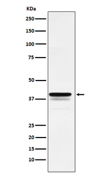 FOXF1 Rabbit Monoclonal Antibody