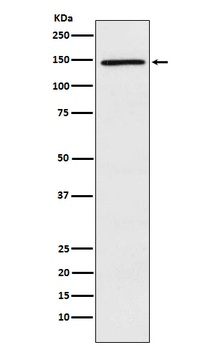 PLCG2 Rabbit Monoclonal Antibody