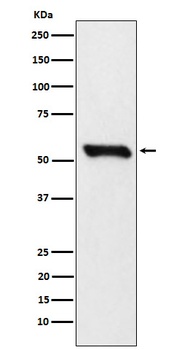 DLDH Rabbit Monoclonal Antibody