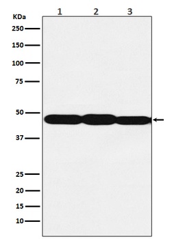 ESE1 Rabbit Monoclonal Antibody